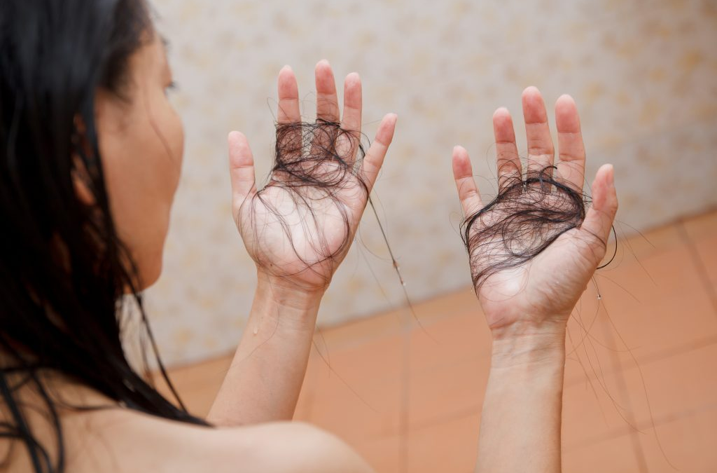 Dealing with severe hair fall?